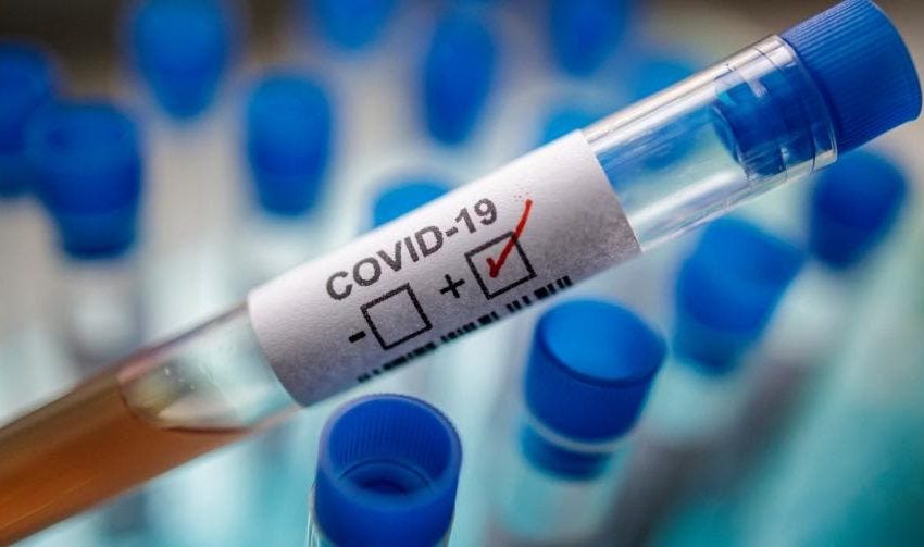  Salud Pública notifica 4 nuevas defunciones y 1,101 casos nuevos covid